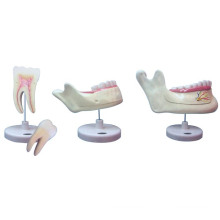 Modelo Dentes Molares / Modelo Dentes Decidui / Modelo Dentes Permanentes